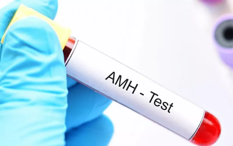 amh testi 1659450704